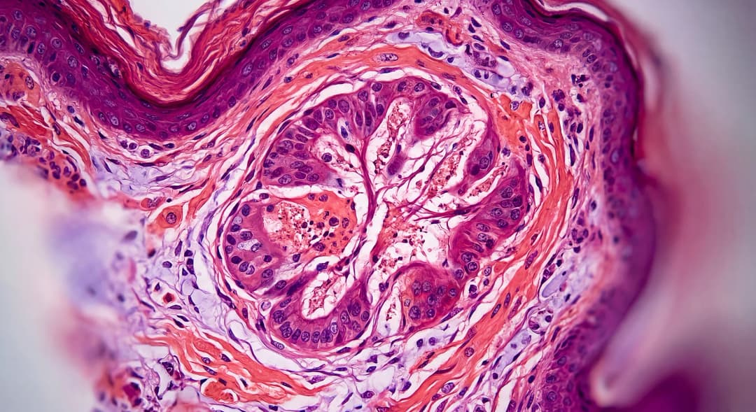 Dermatopathology tissue detail